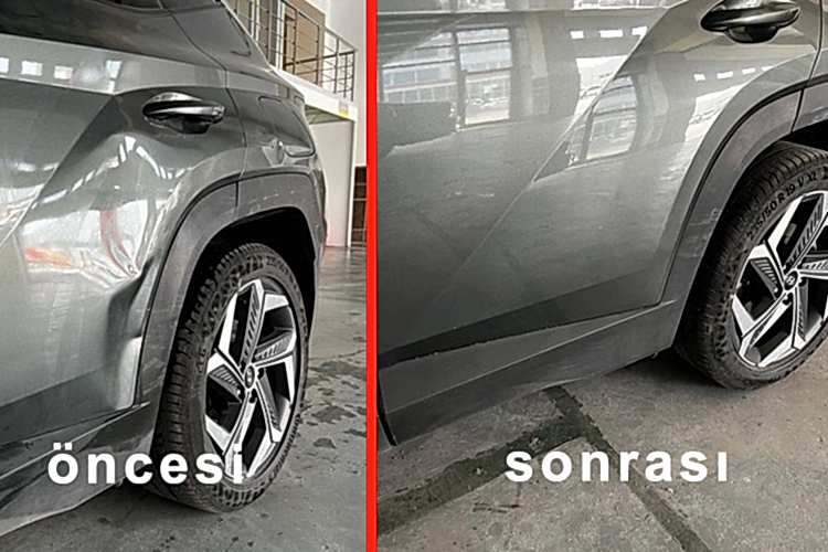 Boyasız Göçük Düzeltme